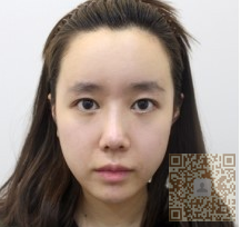 中年大妈面容宛若少女，全靠彭氏童颜术