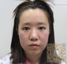 中年大妈面容宛若少女，全靠彭氏童颜术