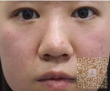 中年大妈面容宛若少女，全靠彭氏童颜术
