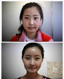 做完超 声 波瘦脸,让wǒ自信起来 做完超 声 波瘦脸,让wǒ自信起来