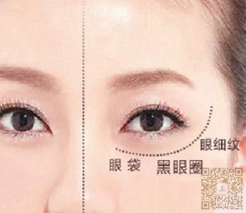 眼袋形成得原因 眼袋形成得原因