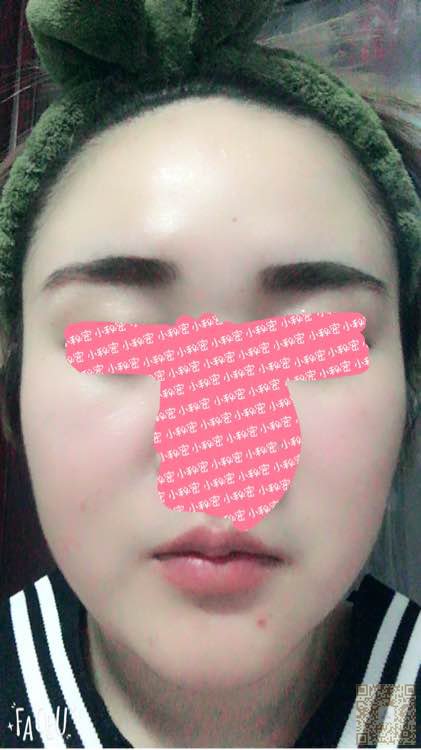 瘦脸分享！！！越瘦越美丽！！545