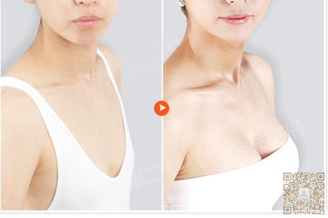 分享wǒ真实得超 声 波丰胸经历 分享wǒ真实得超 声 波丰胸经历