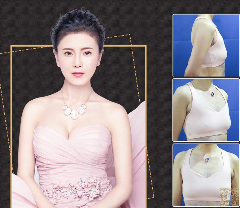 分享wǒ真实得超 声 波丰胸经历 分享wǒ真实得超 声 波丰胸经历