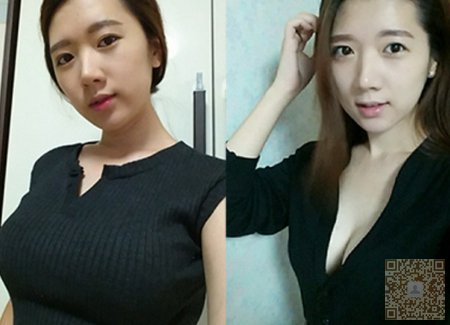 女人要改变就选超声波丰胸392 女人要改变就选超声波丰胸392