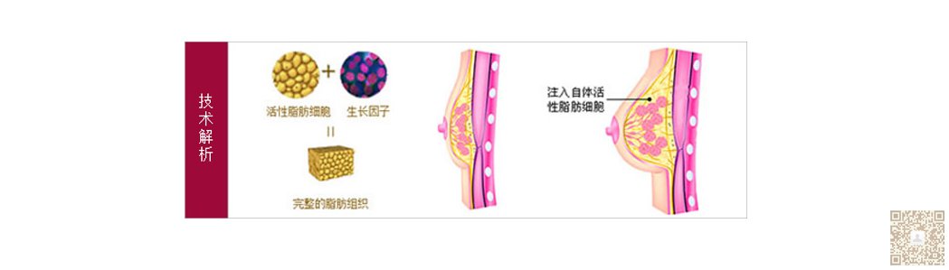 超声波丰胸,为我的胸部打开了春天946 超声波丰胸,为我的胸部打开了春天946