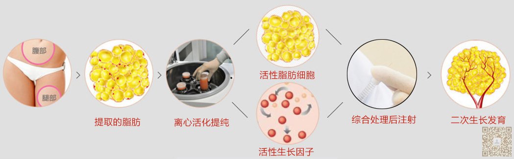 超声波丰胸,为我的胸部打开了春天946 超声波丰胸,为我的胸部打开了春天946