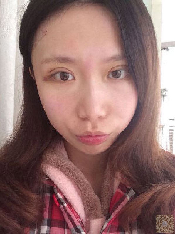 我用超声波双眼皮来奖励我自己的辛勤工作590 我用超声波双眼皮来奖励我自己的辛勤工作590