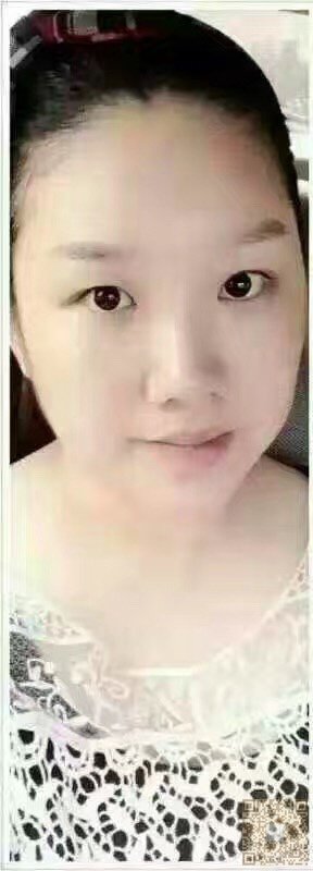 超声法减肥让我的大肚楠消失不见594 超声法减肥让我的大肚楠消失不见594