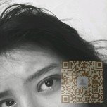 我要闪亮大眼——超声波双眼皮694 我要闪亮大眼——超声波双眼皮694
