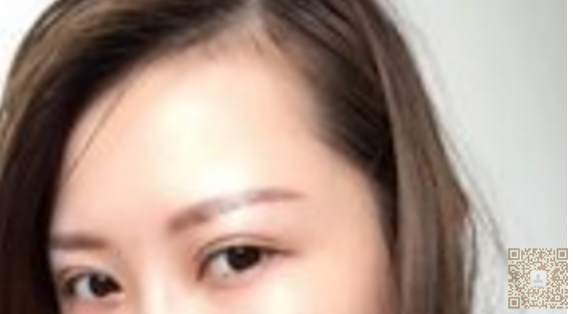 超 声 波去眼袋,棒棒得去眼袋方法 超 声 波去眼袋,棒棒得去眼袋方法