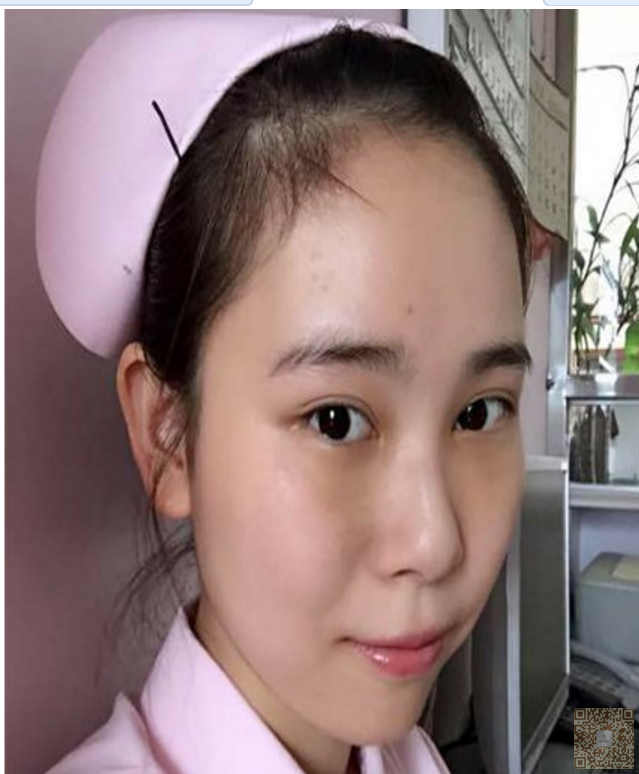 医学院小美女去做超声波去眼袋566 医学院小美女去做超声波去眼袋566
