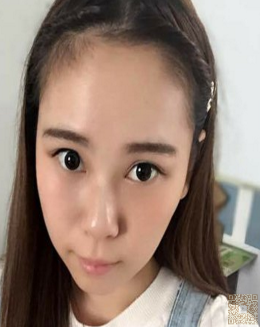医学院小美女去做超声波去眼袋566 医学院小美女去做超声波去眼袋566