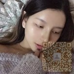 不开刀隆鼻就要在超雅这样做330 不开刀隆鼻就要在超雅这样做330
