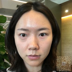 选择超雅超声波去眼袋就对了399 选择超雅超声波去眼袋就对了399
