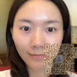 选择超雅超声波去眼袋就对了399 选择超雅超声波去眼袋就对了399