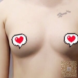 美胸养成记——超雅超声波自体脂肪丰胸827 美胸养成记——超雅超声波自体脂肪丰胸827