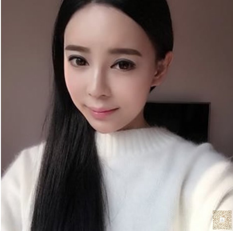 我去超雅做超声波去眼袋的经历谈237 我去超雅做超声波去眼袋的经历谈237