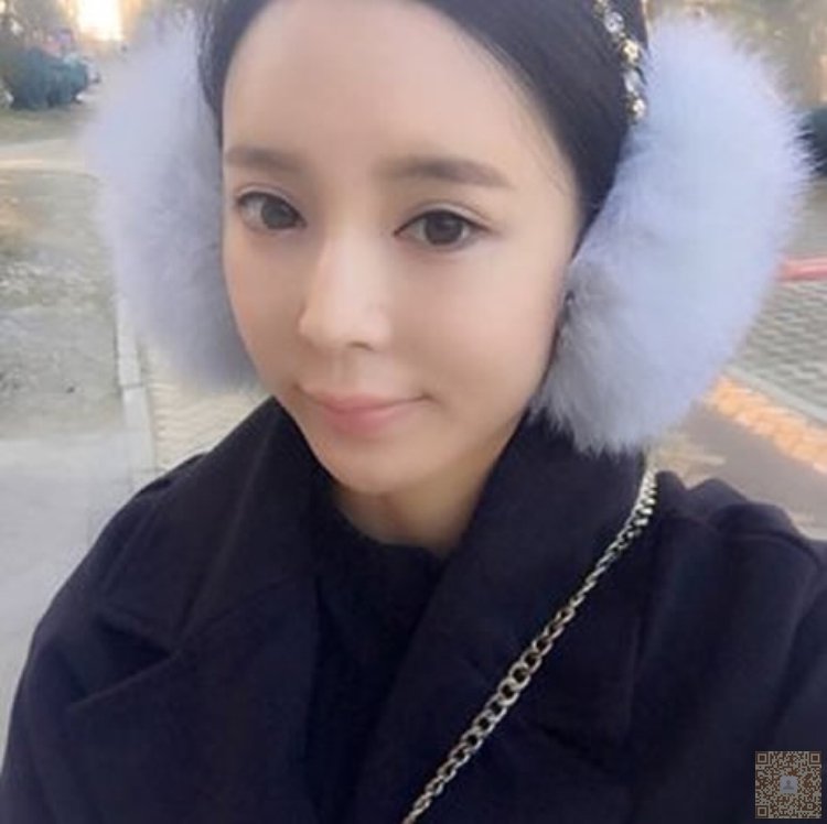 我去超雅做超声波去眼袋的经历谈237 我去超雅做超声波去眼袋的经历谈237