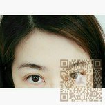 快来围观我的超声波去眼袋手术751 快来围观我的超声波去眼袋手术751