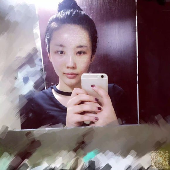 网红也去做不开刀隆鼻771