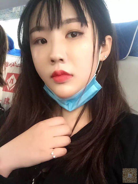 网红也去做不开刀隆鼻771