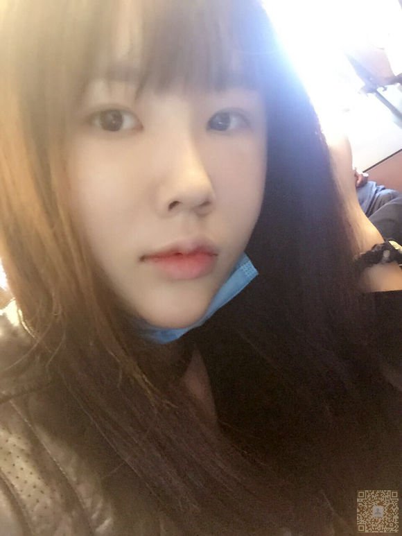 网红也去做不开刀隆鼻771
