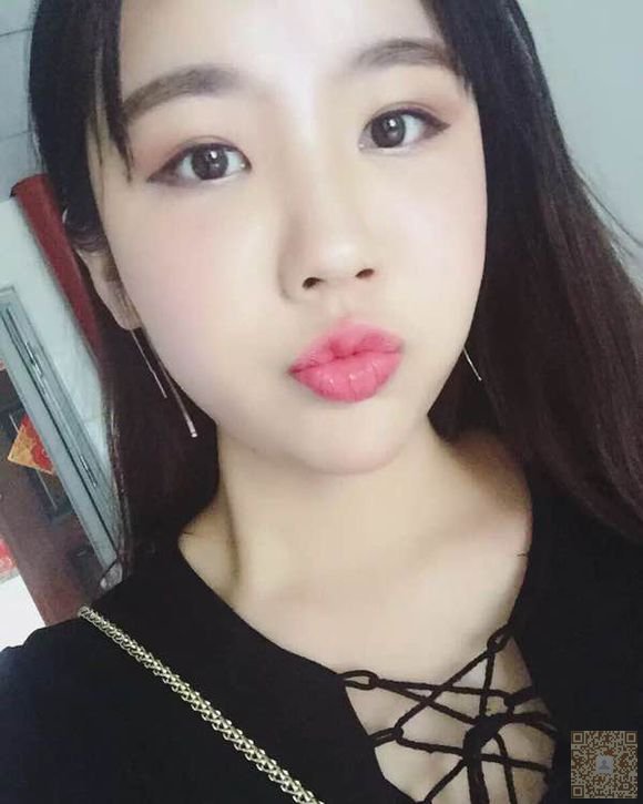 网红也去做不开刀隆鼻771