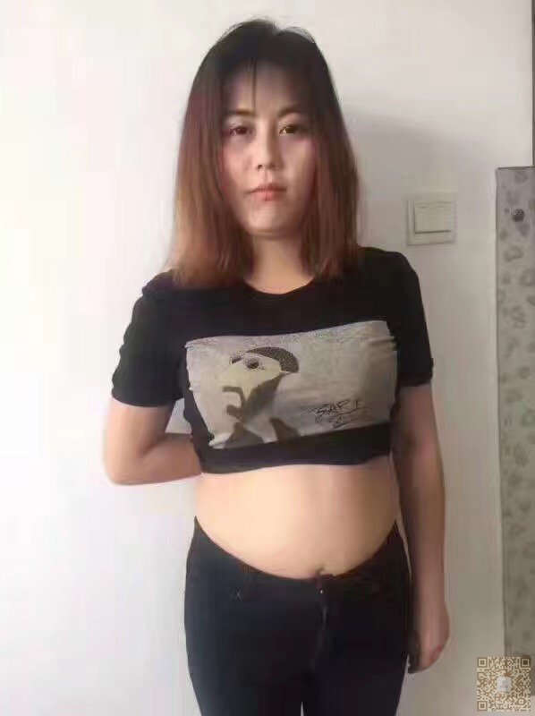 超声波减肥改变我的人生773