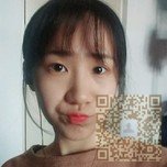 超雅超声波双眼皮手术真的很完美782 超雅超声波双眼皮手术真的很完美782