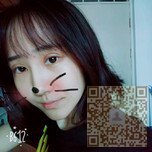超雅超声波双眼皮手术真的很完美782 超雅超声波双眼皮手术真的很完美782
