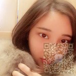 wǒ在超雅做得不开刀隆鼻很靠谱 wǒ在超雅做得不开刀隆鼻很靠谱