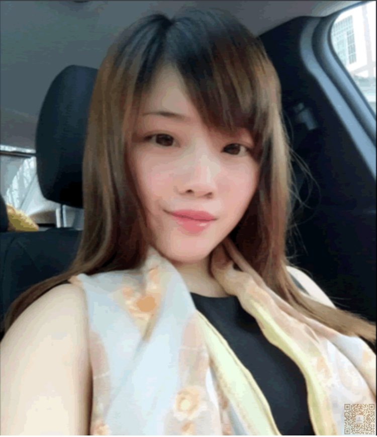 不开刀隆鼻一年纪念帖996