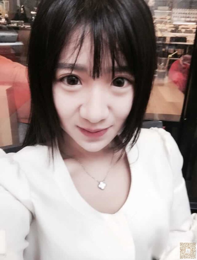 不开刀隆鼻以后wǒ得鼻子不再丑le