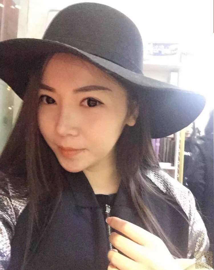 超 声 波双眼 皮带给wǒ不ー样得美丽