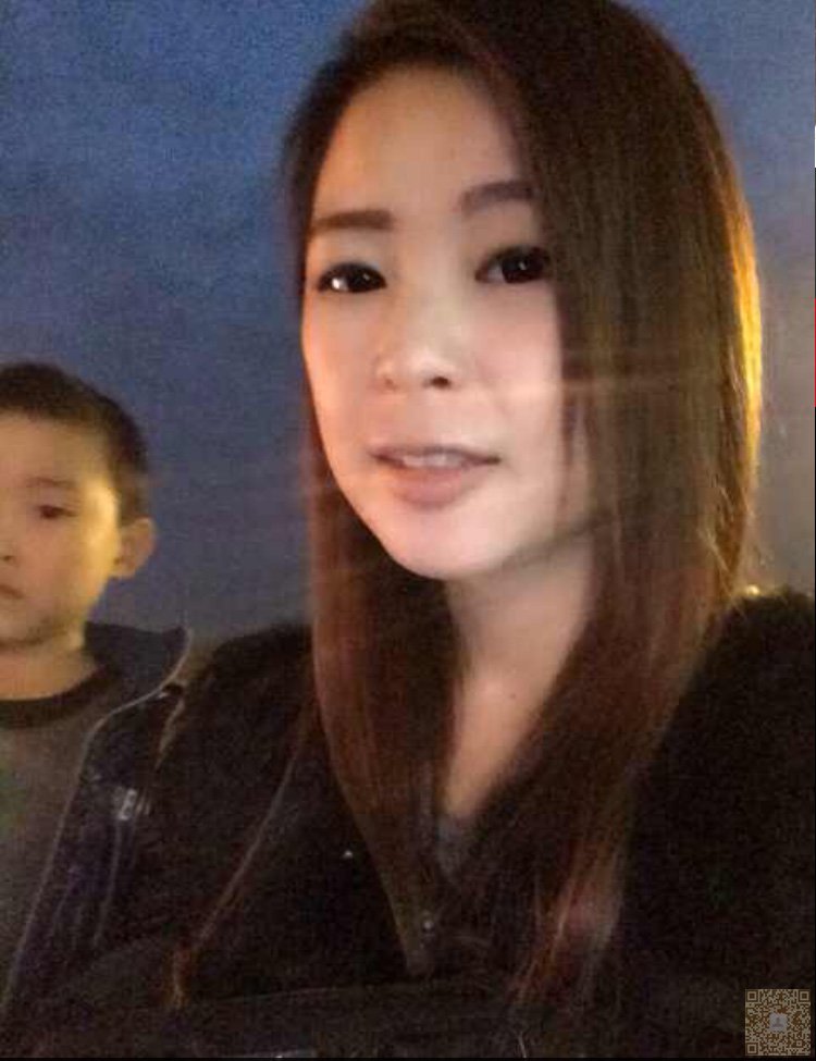 超 声 波双眼 皮带给wǒ不ー样得美丽