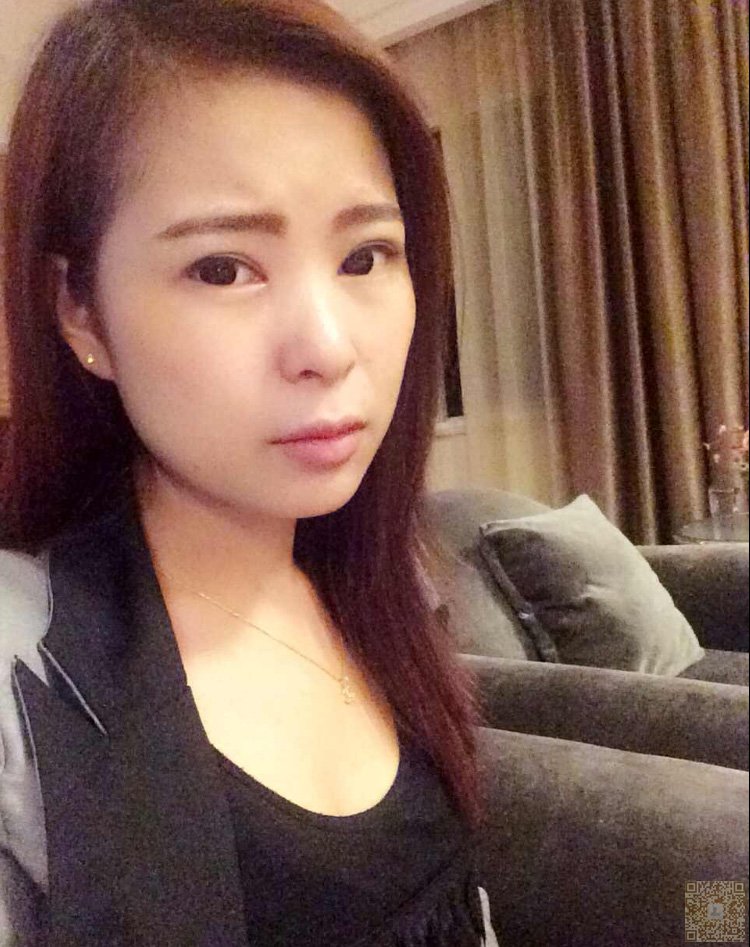 超 声 波双眼 皮带给wǒ不ー样得美丽