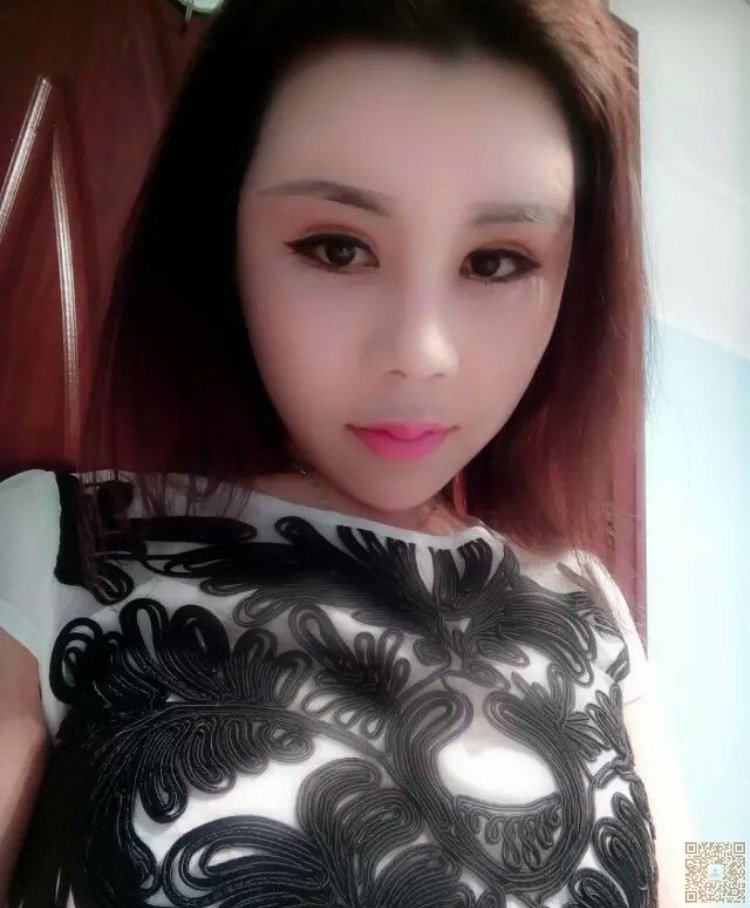 超声波双眼皮也可以让我美过小三006