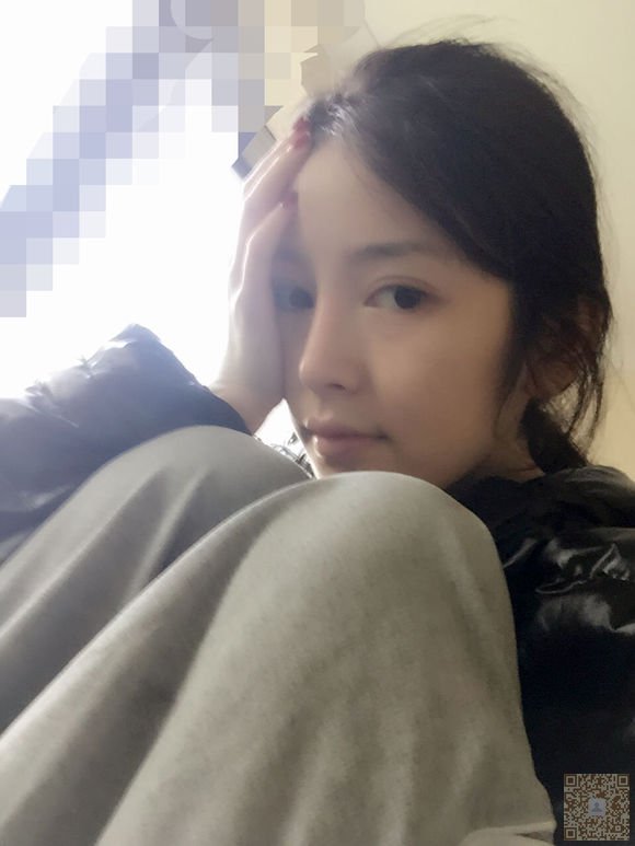 超 声 波双眼 皮迷人美丽做出来 超 声 波双眼 皮迷人美丽做出来