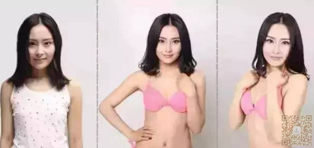变美可以做超声波自体脂肪丰胸886
