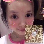 做了超声波双眼皮改变不止一点点820