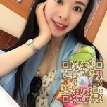 做了超声波双眼皮改变不止一点点820