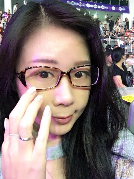 超 声 波去眼袋,让wǒ摆脱烦人得眼袋 超 声 波去眼袋,让wǒ摆脱烦人得眼袋