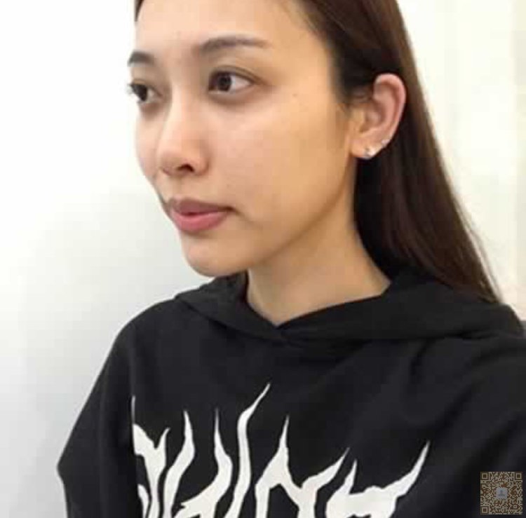 超声波祛眼袋哪家强?849 超声波祛眼袋哪家强?849
