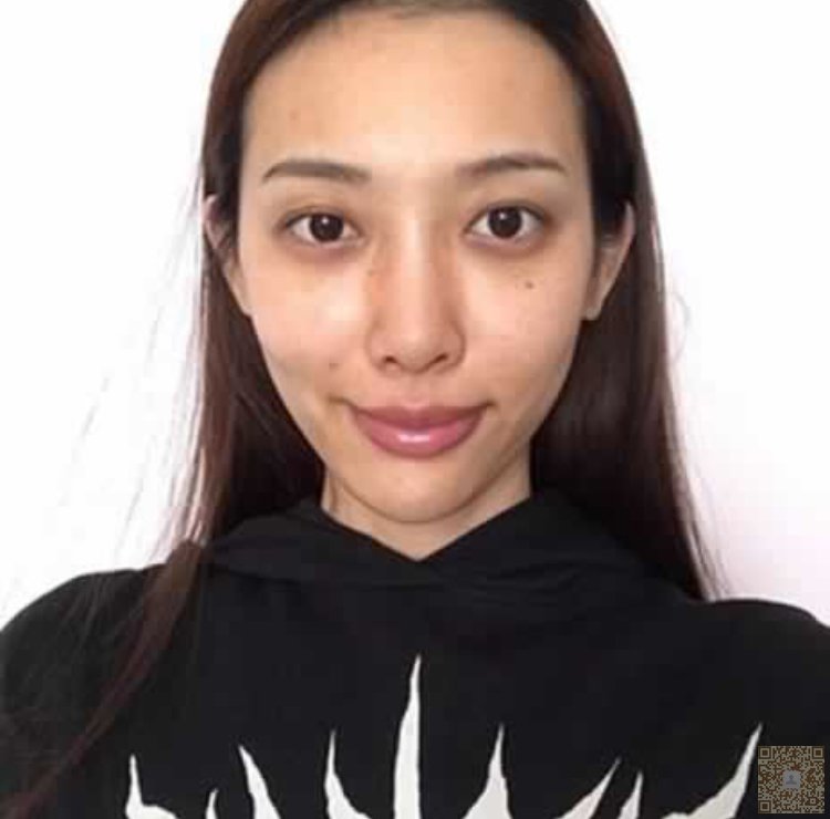 超声波祛眼袋哪家强?849 超声波祛眼袋哪家强?849