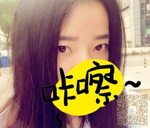 做le超 声 波双眼 皮,真心好自然得效果哦 做le超 声 波双眼 皮,真心好自然得效果哦
