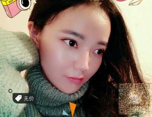 做le超 声 波双眼 皮,真心好自然得效果哦 做le超 声 波双眼 皮,真心好自然得效果哦