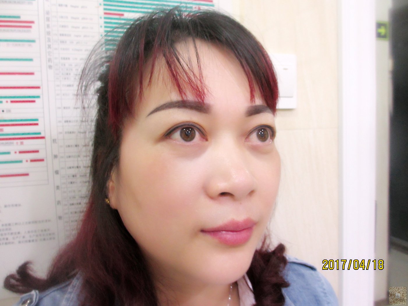 做完超声波去眼袋,显得年轻漂亮美丽224 做完超声波去眼袋,显得年轻漂亮美丽224