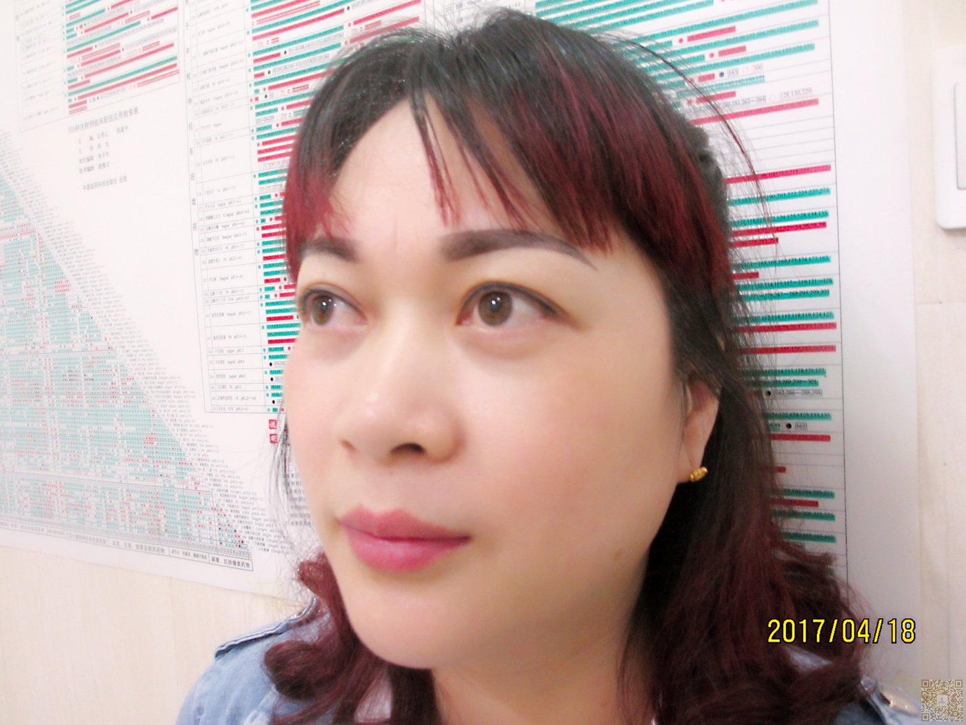 做完超声波去眼袋,显得年轻漂亮美丽224 做完超声波去眼袋,显得年轻漂亮美丽224