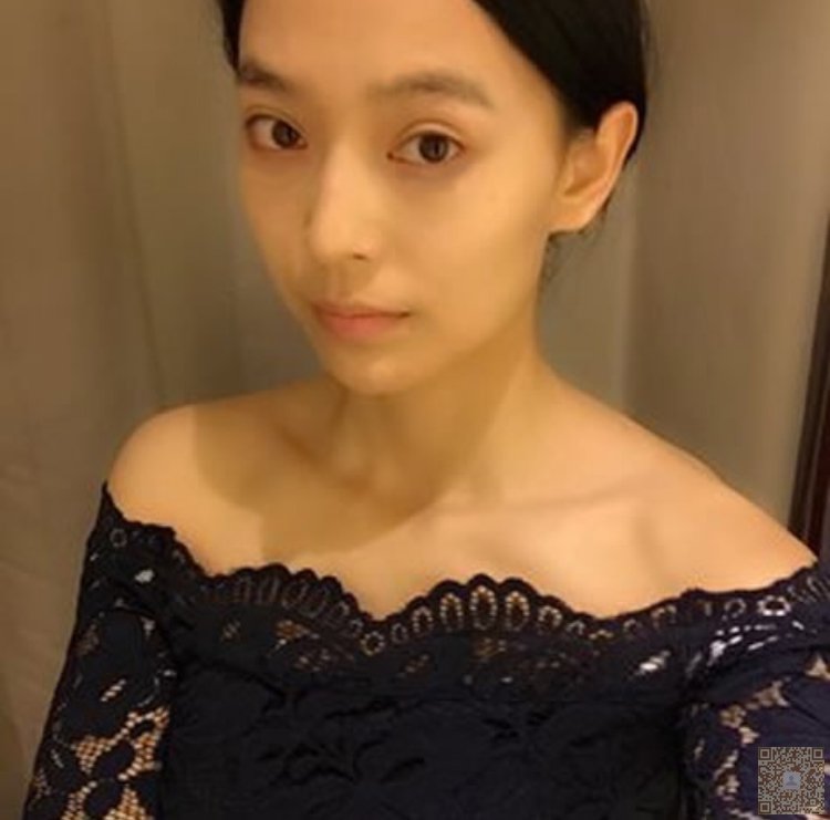 做le超 声 波去眼袋,熬夜也不怕 做le超 声 波去眼袋,熬夜也不怕